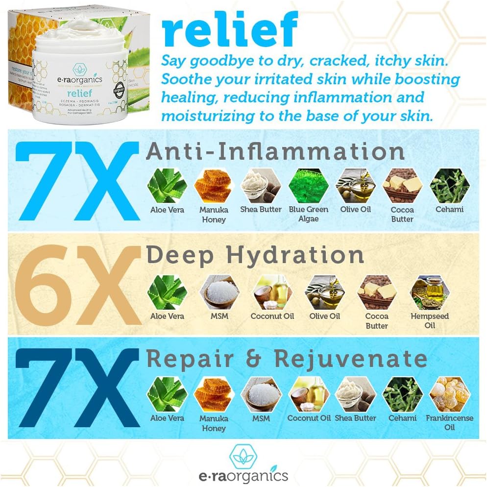 Era Organics Eczema, Psoriasis & Dermatitis Cream - Advanced 15-in-1 Non-Greasy Soothing Moisturizer with Aloe Vera, Manuka Honey, Hemp Oil & More. Face & Body Lotion for Dry Itchy Skin Care 4oz: Health & Personal Care
