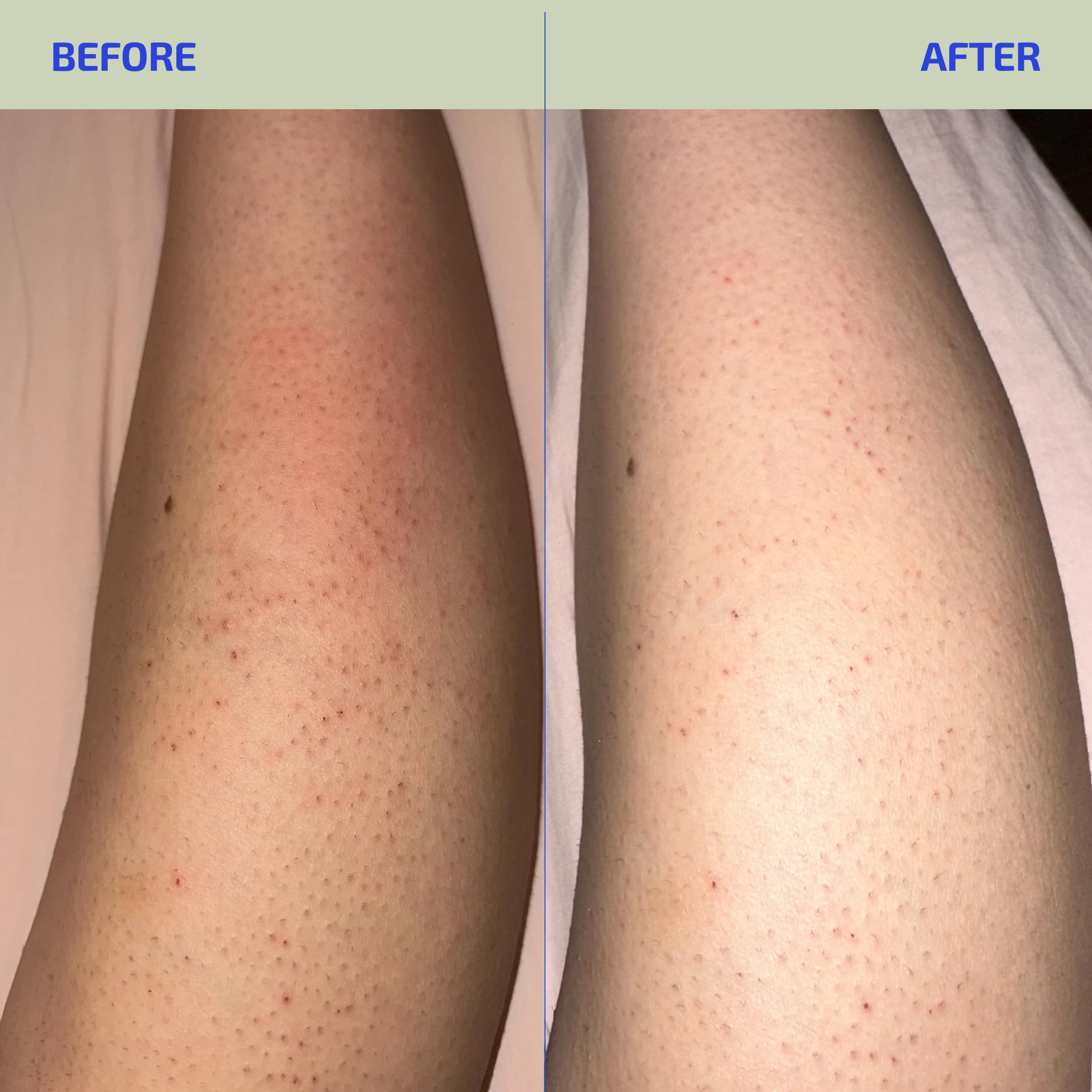 Codex Labs BIA Eczema Relief Lotion, 3.4 oz - Clinically Proven Colloidal Oatmeal 1% for Itchy Dry Eczema Prone Skin - Fragrance Free Moisturizer with BiaComplex 2.0 - Safe for Babies, Kids & Adults