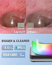 Anykit Digital Otoscope with Gyroscope, 4.5 Inches