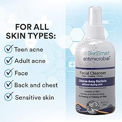SkinSmart Facial Cleanser for Breakouts, Targets