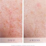 IS CLINICAL Active Serum 1 Fl Oz Face Serum Even Tone Anti-Aging Blemish view 5