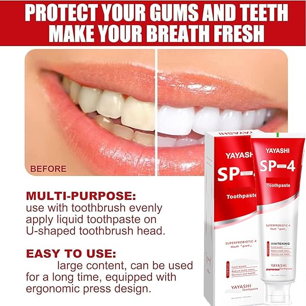 TWWKDD 120G YAYASHI SP-4 TOOTHPASTE, YILIKU SP-4 PROBIOTIC TOOTHPASTE, SP-4 BRIGHTENING TOOTHPASTE FRESH BREATH TOOTHPASTE, SP-4 BRIGHTENING & STAIN REMOVING TOOTHPASTED