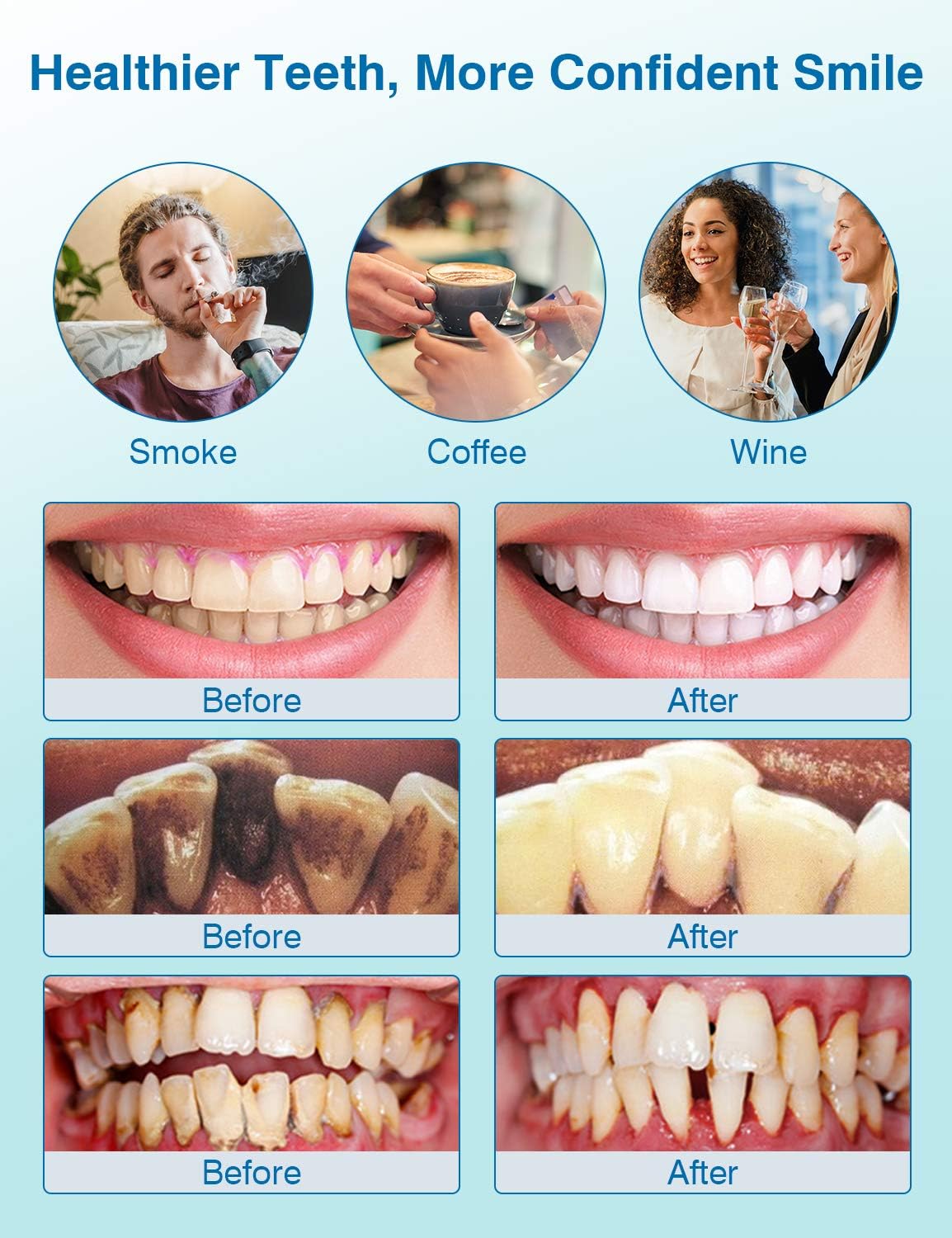 Plaque Remover for Teeth, Sonic Tooth Cleaner Tartar Remover, Electric Teeth Cleaning Kit with 2 Replacement Heads and 1 Tongue Scraper, 5 Adjustable Modes, Safe for Adult and Kids: Health & Personal Care