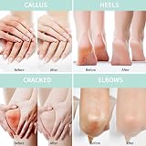 Grocerism Urea Cream 20% 2% Salicylic Acid Foot Cream 150g Pack of 2 view 4
