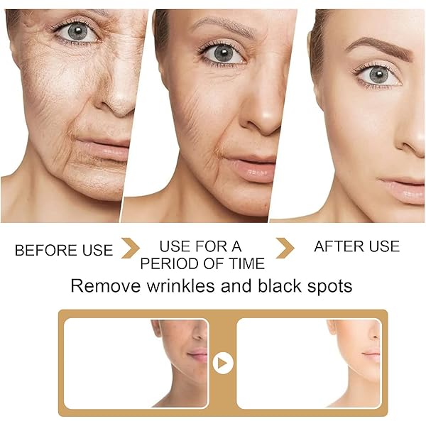 2022 NEW TURMERIC DARK SPOT CORRECTOR SERUM, TURMERIC REPAIR FACE SERUM, BRIGHT SKIN DARK SPOT SKIN CARE MOISTURIZING REPAIR SERUM. 30ML