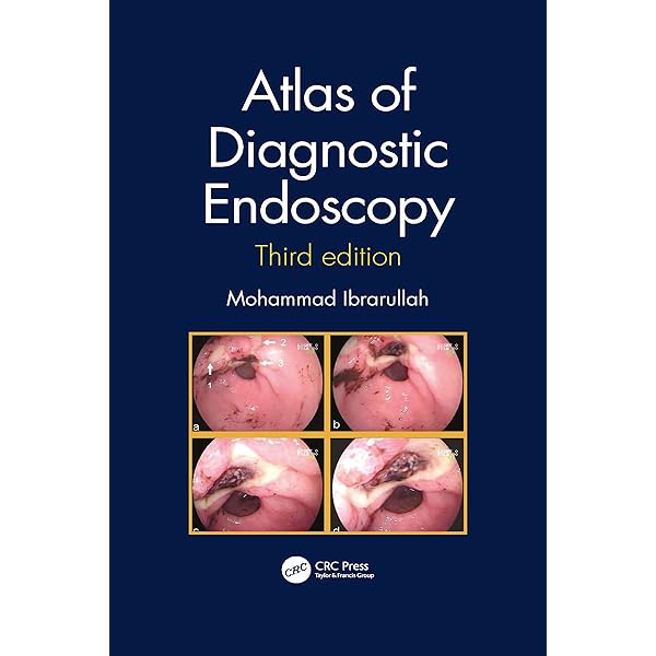 Atlas of Diagnostic Endoscopy, 3E: 9780367345006: Medicine