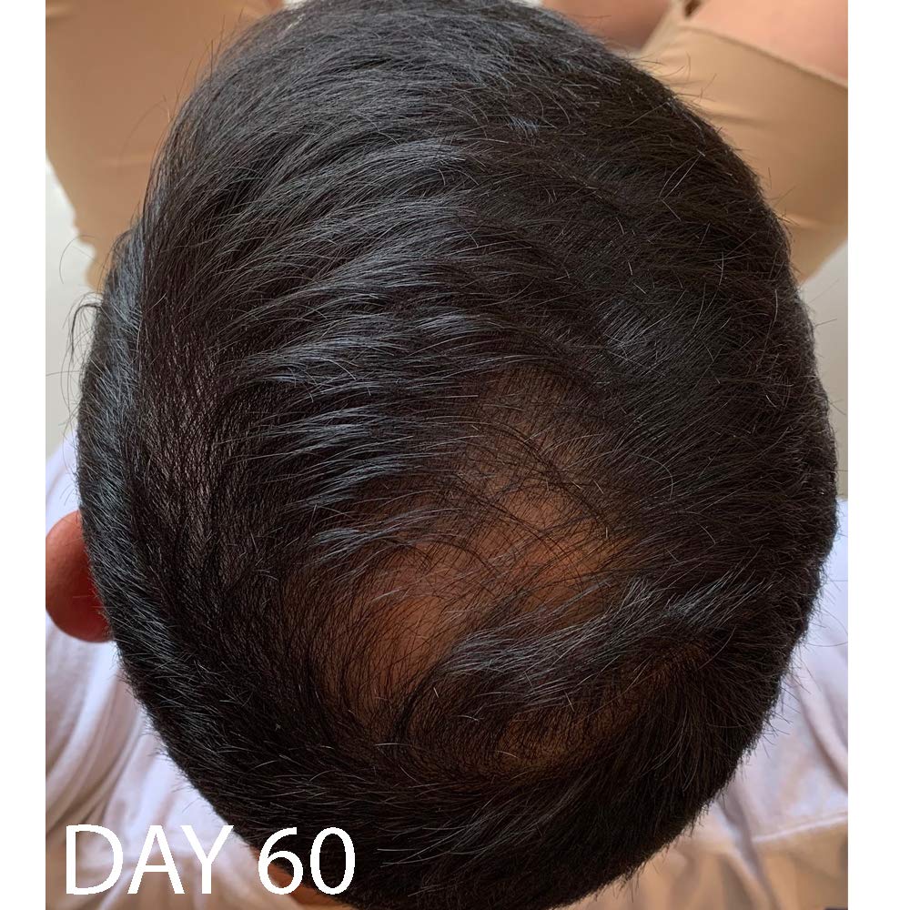 Biotin Vitamin Hair Growth Conditioner-(High Potency) Biotin Conditioner For Fastest Hair Growth, Anti Hair Loss Conditioner, Vitamins E, A, And C, B. THE PRODUCT: Beauty