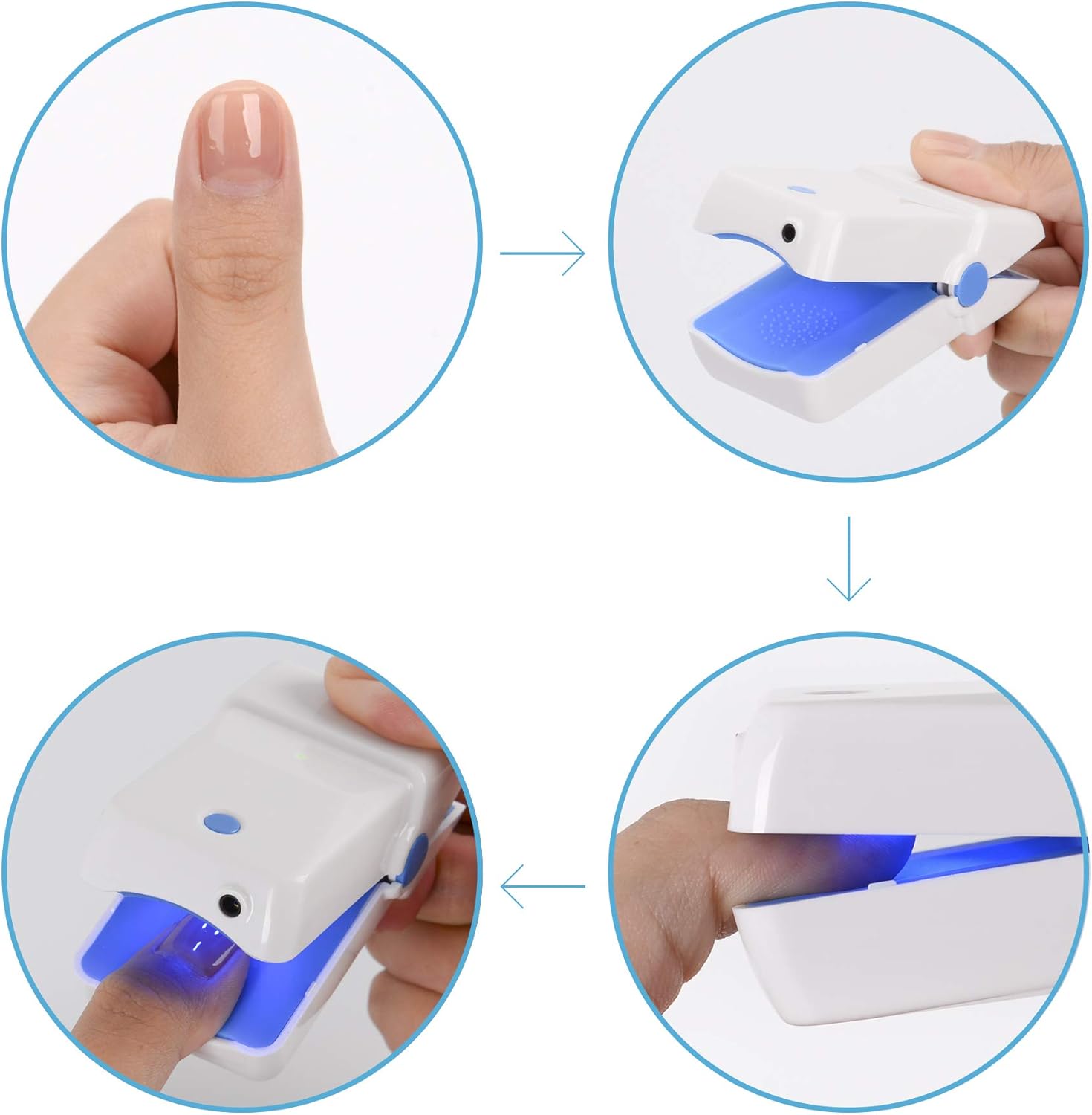 Tippytoe Nail Fungus Remover Laser Device, Safer, Quicker Results, Painless Therapy Treatment For Toes And Fingernails, No Side Effects, Portable, Treats Nail Discoloration, For Home Use: Health & Personal Care