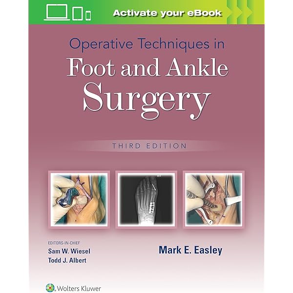 足と足首の手術　Surgery of the foot and ankle 2冊 足・足関節の最新の手術 (OS NEXUS(電子版付き) 19) | 中村 茂