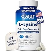Lysine Cold Sore Treatment, L-Lysine Capsules with Probiotics &amp; Vitamin C | Stops Outbreaks Before They Start, Internal Lysine Defense, Not A Topical Cover-up For Cold Sores