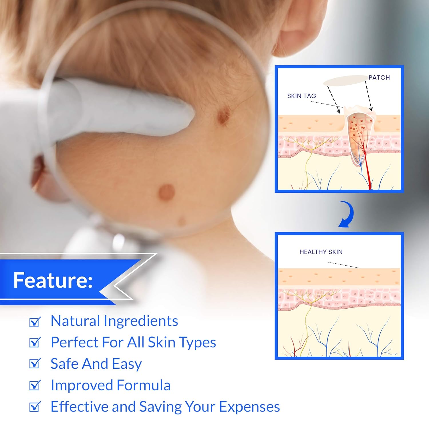 Novome Skin Tag Remover Patches - Wart Remover Patches - Natural Ingredients - Cover And Conceals Skin Tags - Perfect For All Skin Types (108 Patches)… : Beauty