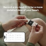 AliveCor KardiaMobile 6 Lead Personal ECG Heart Monitor NHS Trusted view 4