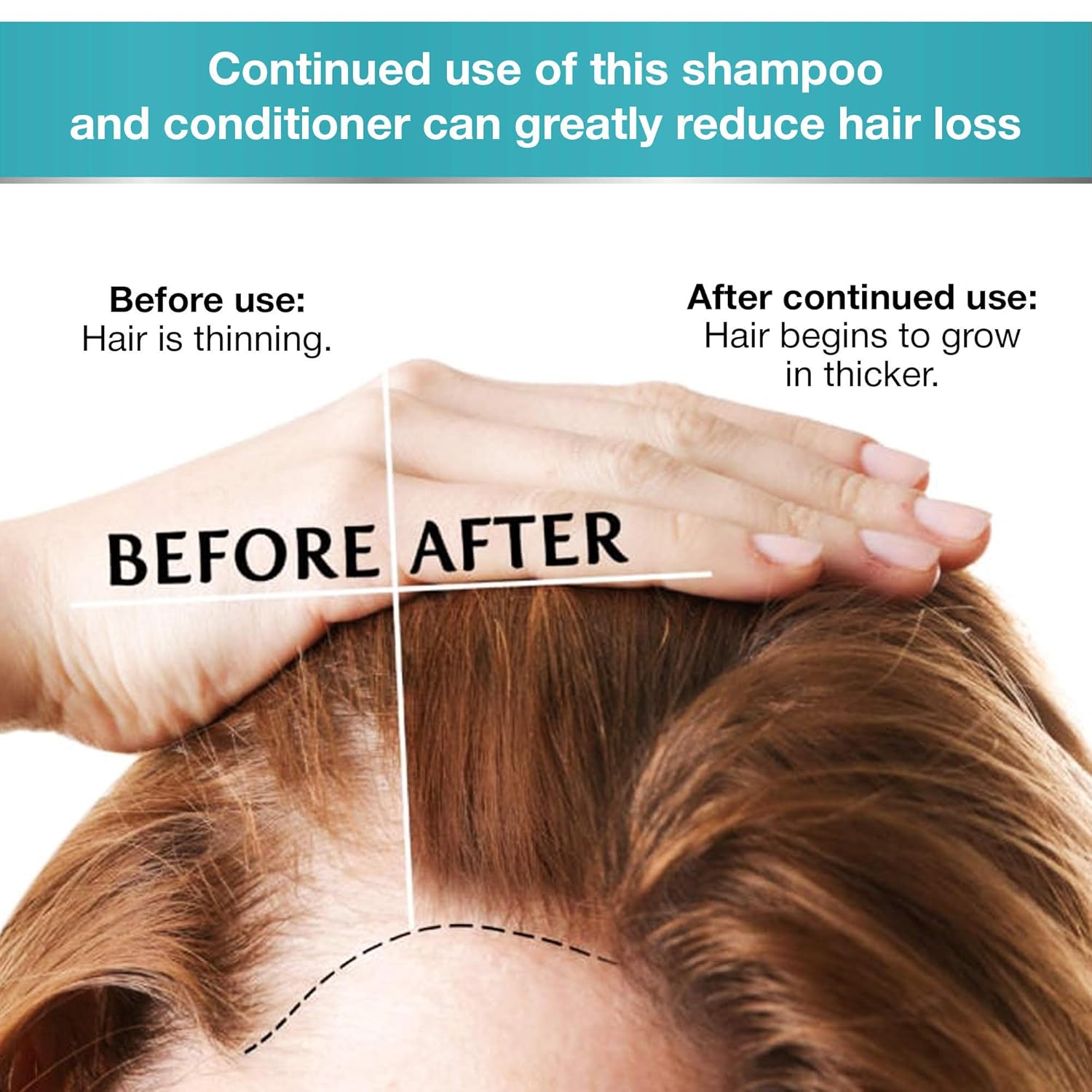 Biotin Shampoo and Conditioner for Hair Growth | Thickening Anti Hair Loss Shampoo Treatment | Regrowth Shampoo & Conditioner for Dry Normal Oily & Color Treated Hair: Beauty