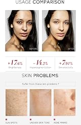 XJBD Skin Daily Niacinamide 4pc Skincare Set Facial Cleanser Toner Serum Cream view 5
