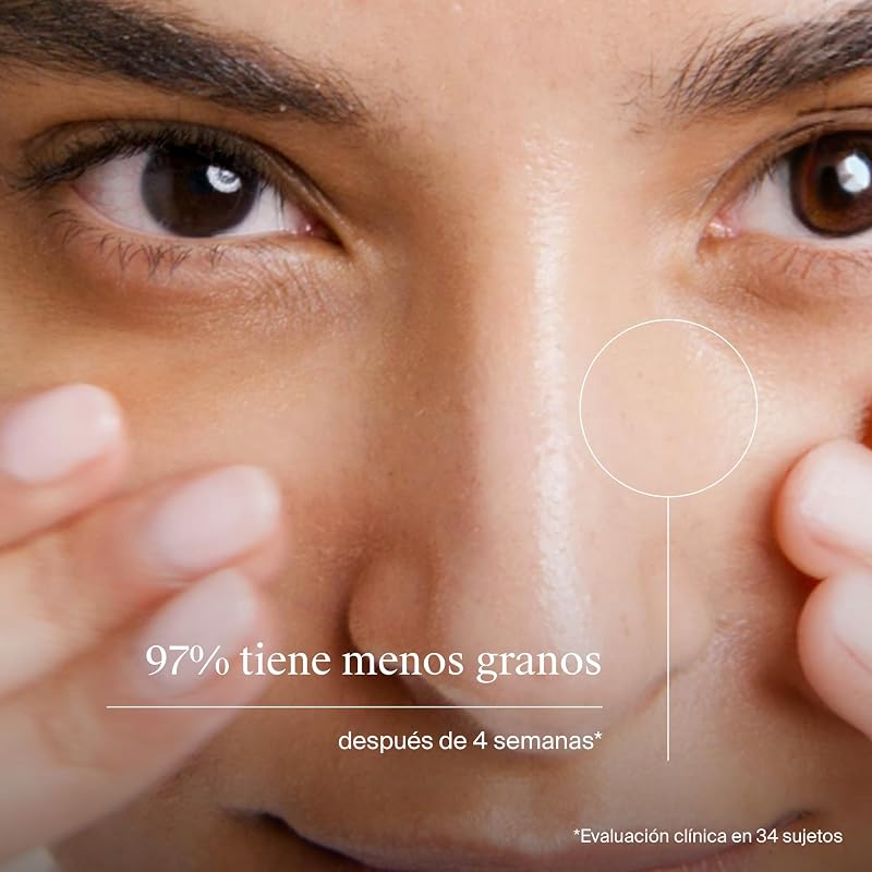 Spot Controlling Limpiador Facial 2% Ácido Salicílico (200 ml), jabón facial para pieles propensas al acné, gel limpiador suave de uso diario