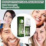 HIVETZ Mouth Ulcer Treatment Spray Herbal Breath Freshener Adults view 9