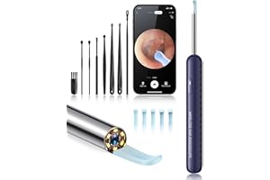 Loyker Ear Wax Removal Tool Camera, Ear Cleaner with 1080P Camera, Earwax Removal Cleaning Kit with 6 Ear Pick, Otoscope for iPhone, iPad, Android Phones, Blue