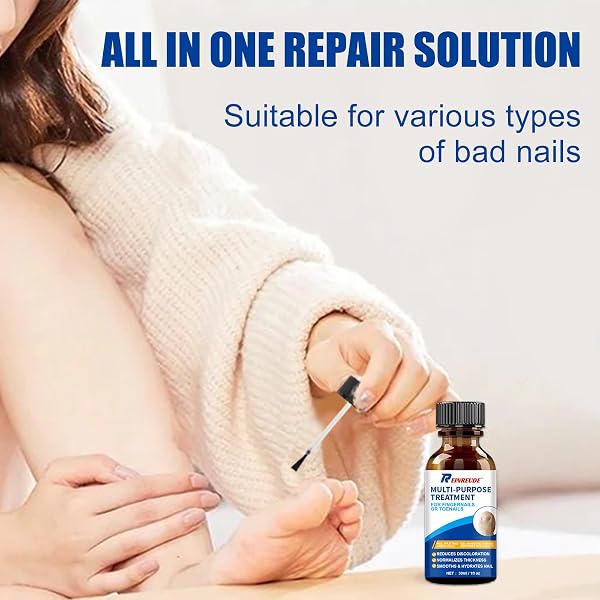 TOENAIL FUNGUS TREATMENT EXTRA STRENGTH 30ML, WUNILA MULTI-PURPOSE NAIL REPAIR SOLUTION FOR DISCOLORED DAMAGED NAILS, PLANT OIL FOR FUNGAL NAIL FUNGUS TREATMENT FAST ACTING, TOE NAIL FUNGUS TREATMENT