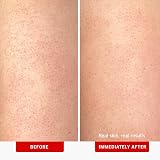 First Aid Beauty KP Bump Eraser Body Scrub 10% AHA 56.7g Exfoliator view 3