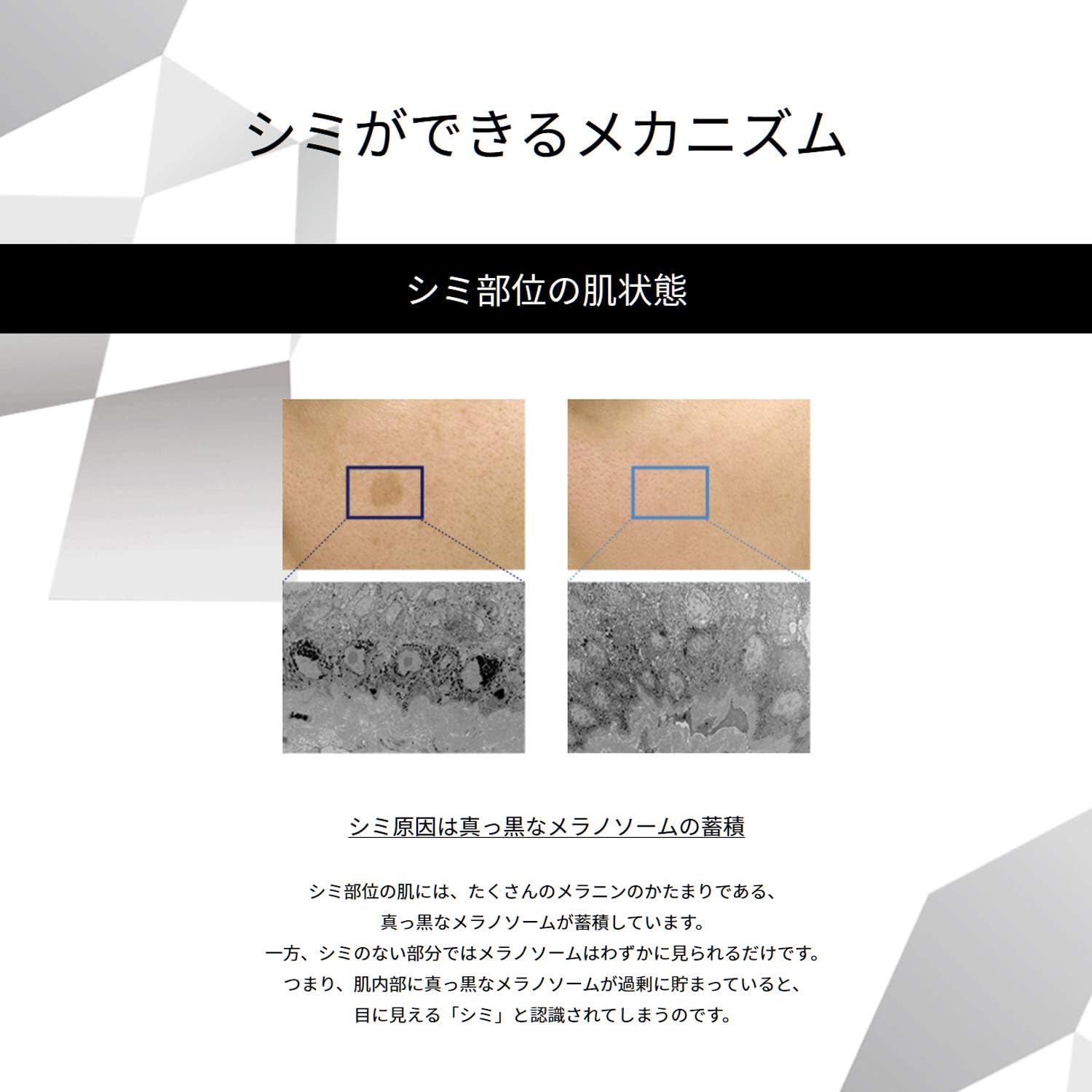 Amazon One By Kose ワンバイコーセー One By Kose メラノショット ホワイト 本品 単品 40ml One By Kose ワンバイコーセー ビューティー 通販