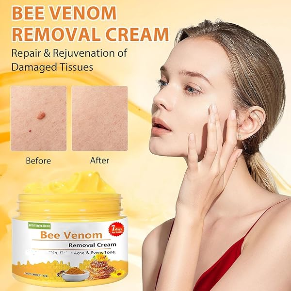 KLIFE BEE VENOM REMOVAL CREAM, 2024 NEW BEE VENOM CREAM, NATURAL BEE VENOM CREAM, PROFESSIONAL BEE VENOM CREAM FOR ALL SKIN TYPES(2PCS)