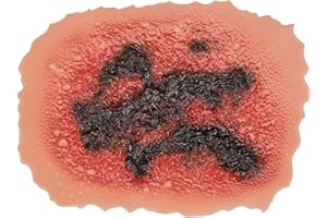 MedEduQuest Burn Wound Packing Trainer, Burn Moulage, Adhesive Skin Burn Wound Trainer for Wound Care Training, Fourth Degree