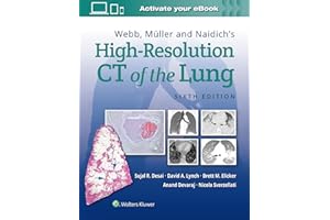 Webb, Müller and Naidich's High-Resolution CT of the Lung
