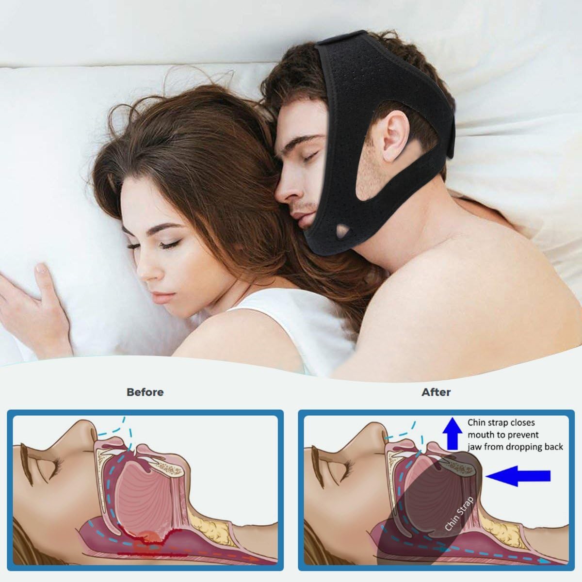 Anti Snoring Chin Strap - Breathable & Naturally Stop Snoring Device, Patent Design w/Promoting Blood Circulation Magnets, Adjustable Snore Reduction Belt for Men & Women to Improve REM Sleep: Health & Personal Care