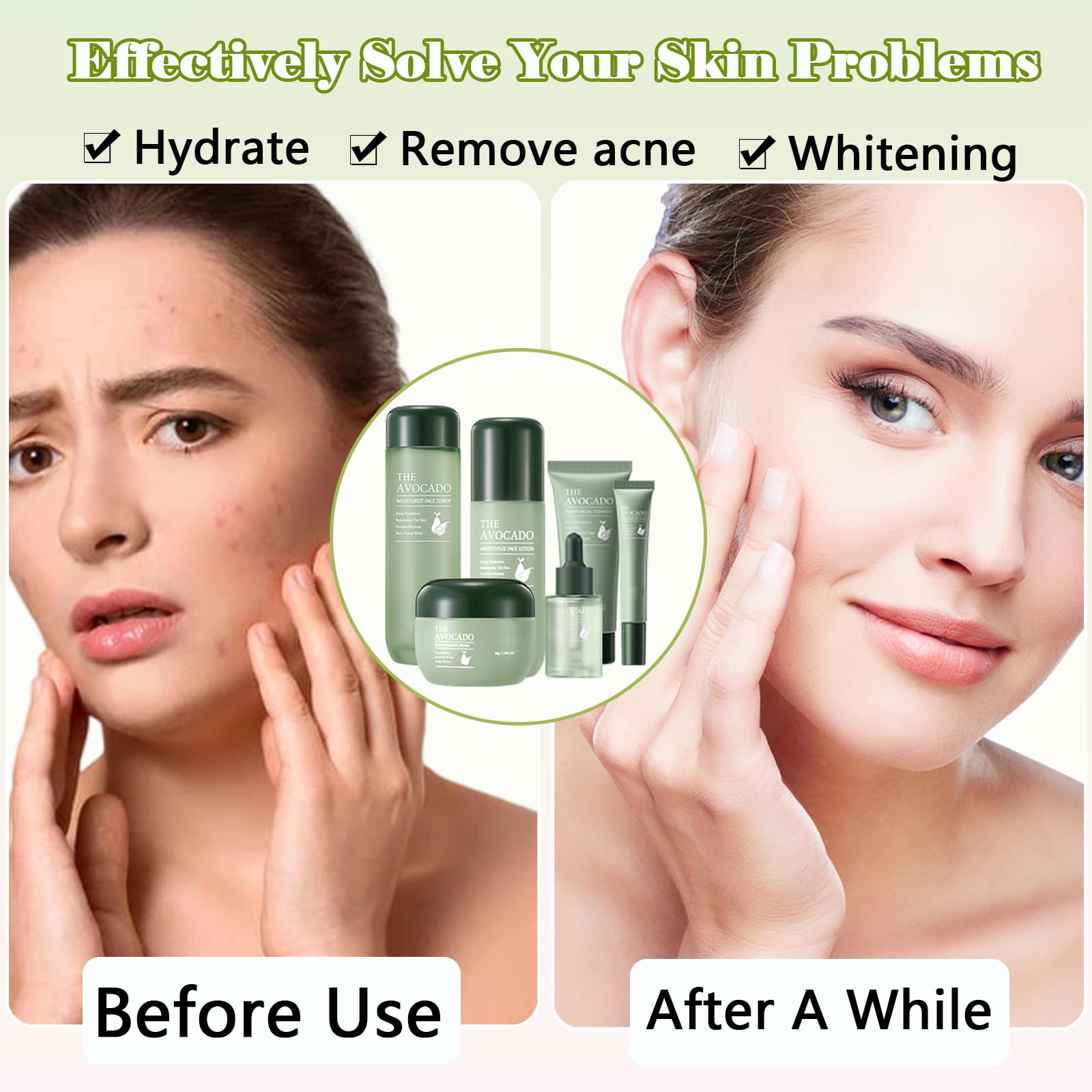 Avocado Skin Care Set for Women,6PCS Skincare Gift Kits,Stocking Stuffers,Christmas Gifts for Women,Moisturizing Korean Skincare Set with Facial Cleanser, Toner, Serum, Lotion,Cream, Eye Cream