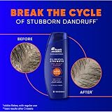 Head & Shoulders Clinical Strength Dandruff Shampoo 13.5 oz For Itching Redness view 6