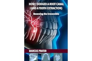 How I Dodged a Root Canal (and a Tooth Extraction): Reversing the Irreversible