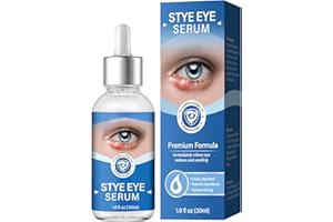 HENITAR Stye Eye Treatment, Stye Eye Serum for Styes Chalazion and Blepharitis, Cleanses Lashes and Eyes, Restore Healthier Eye Skin, 1.01 Fl oz