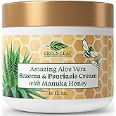 Manuka Honey Eczema Cream Moisturizing Lotion For Psoriasis Relief - Itchy, Dry Skin Rash Ointment -Skin Soothing Moisturizer Baby Kids & Adults-High Strength Body & Face Cream 16oz