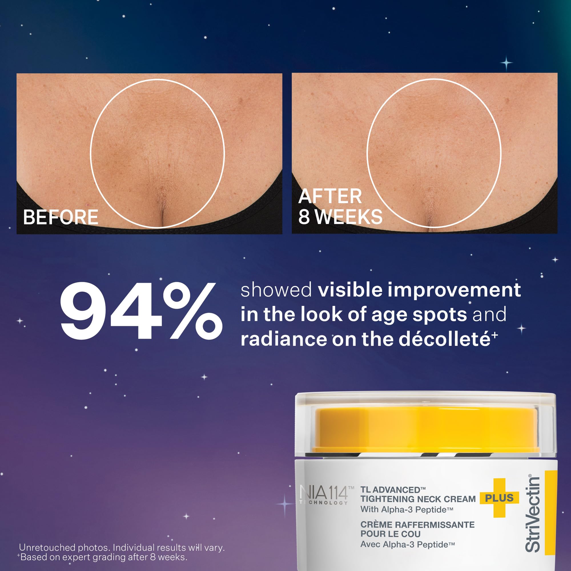 StriVectin TL Advanced? Holiday Duo Tighten and Sculpt Kit, Brighten and Lift Skin Tone, Peptides and Hyaluronic Acid