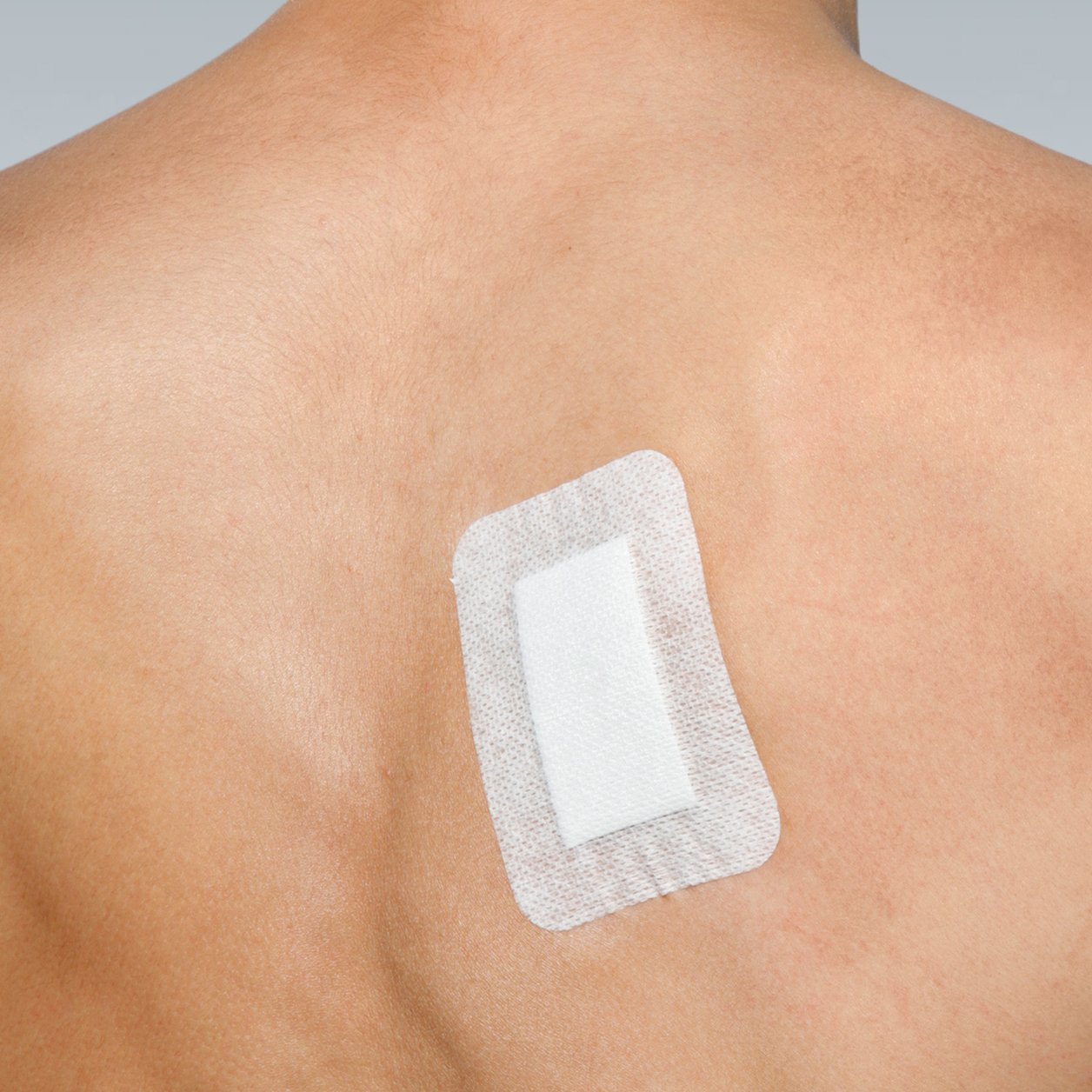 Steropore Adhesive Wound Dressings (10cm x 9cm) - Image 3