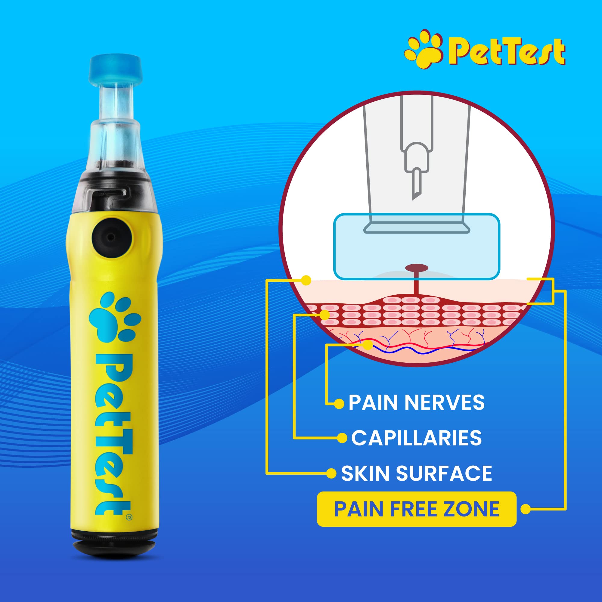 PetTest Painless Glucose Monitoring Kit for Dogs & Cats, Diabetic Pet Blood Sugar Check Gear, Includes Classic Meter, 50 Test Strips, Genteel Lancing Device, 50 Lancets, Soft Carrying Case, and More