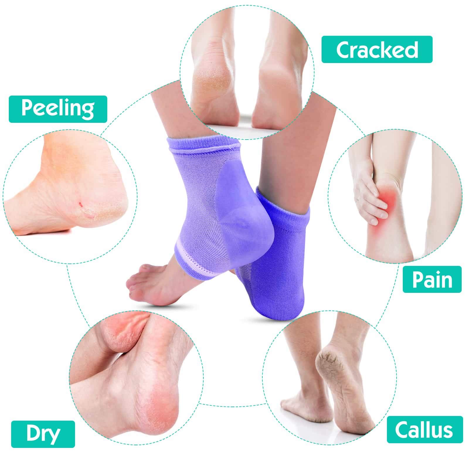 selizo Selizo 6 Pairs Heel Moisturizing Socks Open Toe Socks Cracked Gel Heel Socks Foot Toeless Heel Repair Socks for Women Dry Hard Cracked Feet, 6 Colors