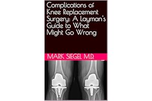 Complications of Knee Replacement Surgery: A Layman's Guide to What Might Go Wrong (Knee Replacement Surgery: What you need t