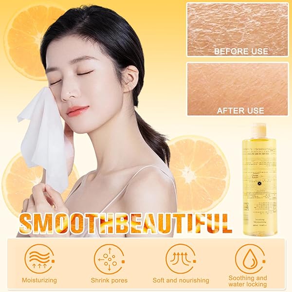 VC TONER,VC TONER REFRESHING HYDRATING REJUVENATING,HYDRATING FACIAL TONER,REFRESHING WATER LOTION FOR ALL SKIN TYPES,300ML
