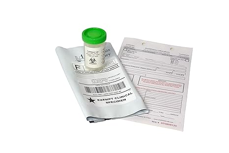 Buy Kidney Stone Analysis Test Kit Online At Low Prices In India Amazon In