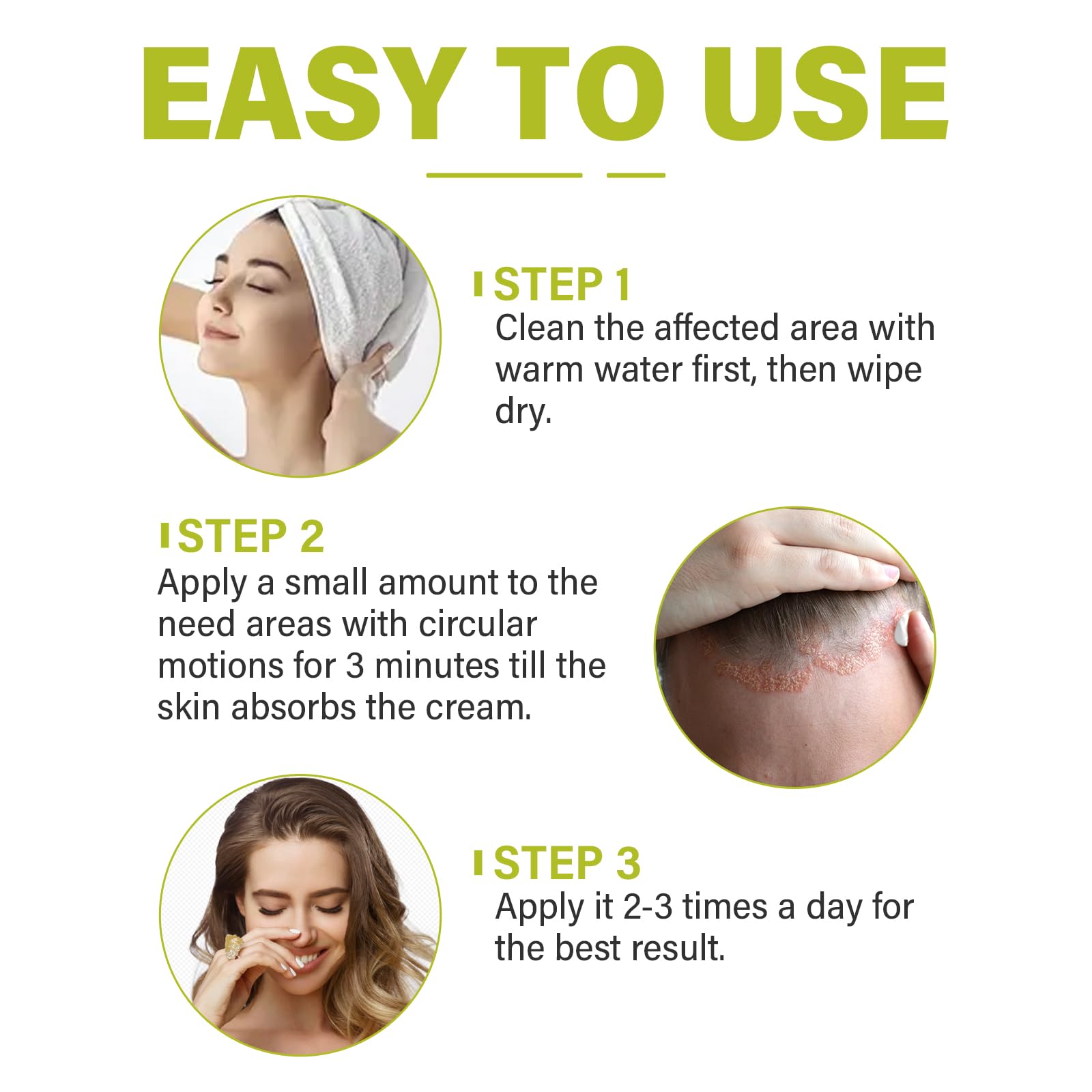 Sêborrheic Dêrmatitis Cream for Fôlliculitis Treatment, Psôriasis Rêlief for Adults, Premium Eczêma Lotion for Dândruff Treatment and Effective Rêlief Îtchy Skin, 2.1 Oz