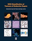 WHO Classification of Tumours of Endocrine Organs (IARC WHO Classification of Tumours)
