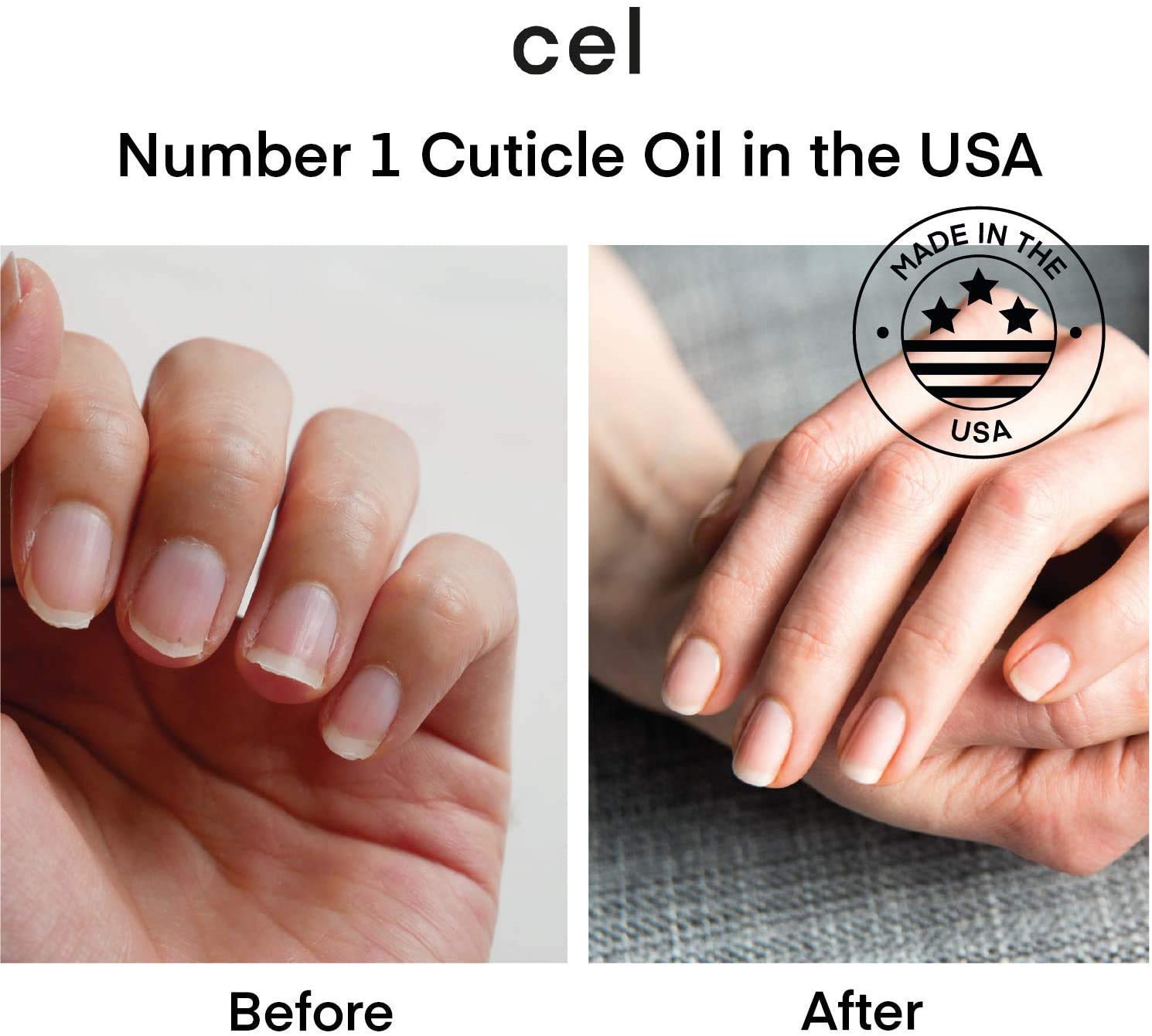 Cel MD Cuticle Oil Pen Nail Strengthener Repair Serum – Nail Repair For Damaged Nails – Helps Repair & Nourish Cracked Nails and Rigid Dry Cuticles - Set of 2: Beauty