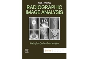 Radiographic Image Analysis - E-Book