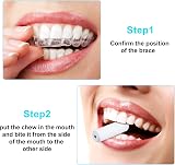 Boao 20 Pieces Aligner Tray Seaters - Silicone Trays in 5 Colors view 5