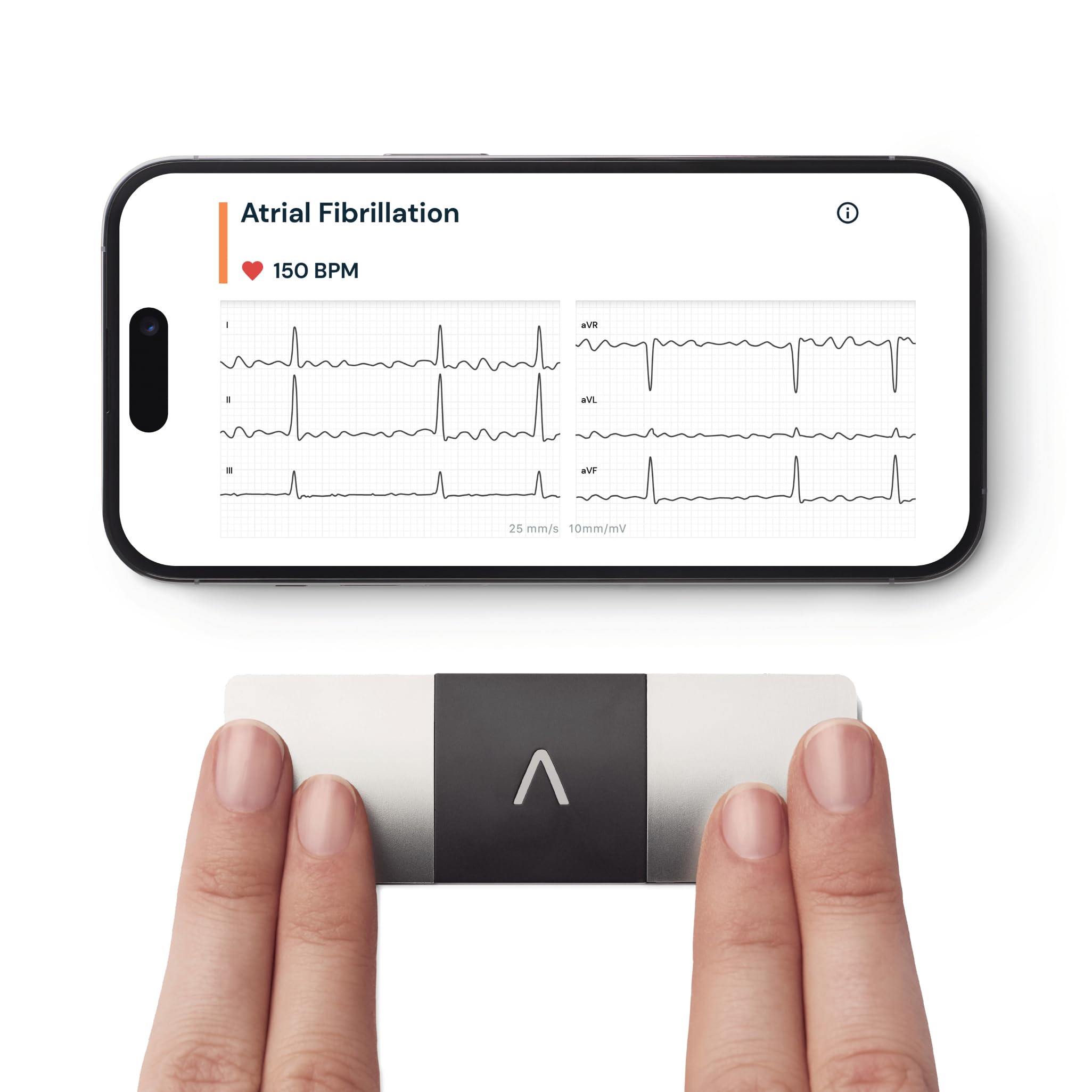 KardiaMobile 6-Lead Personal ECG Heart Rate Monitor - Detects Atrial Fibrillation, Trusted by the NHS, Results in 30 Seconds, Works with Most Smartphones, Supporting British Heart Foundation