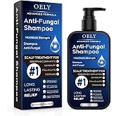 oely Antifungal Shampoo for Seborrheic Dermatitis, Folliculitis - Fresh | Scalp Psoriasis &amp; Anti-Dandruff Shampoo for Men &amp; Women, Relieves Scalp Itching, Dryness, Sulfate &amp; Paraben-Free, 10.1 Fl Oz