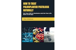 How To Treat Palmoplantar Pustulosis Naturally: Put Your PPP In Remission And Get Your Life Back!