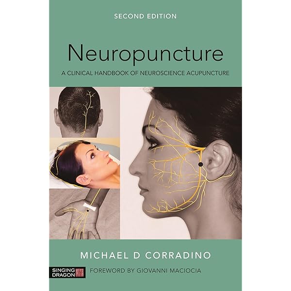 洋書 Yamamoto Neue Schaedelakupunktur (YNSA) Yamamoto New Scalp Acupuncture (YNSA): Development
