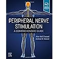 Peripheral Nerve Stimulation: A Comprehensive Guide